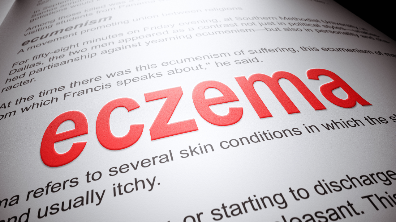 Eczema